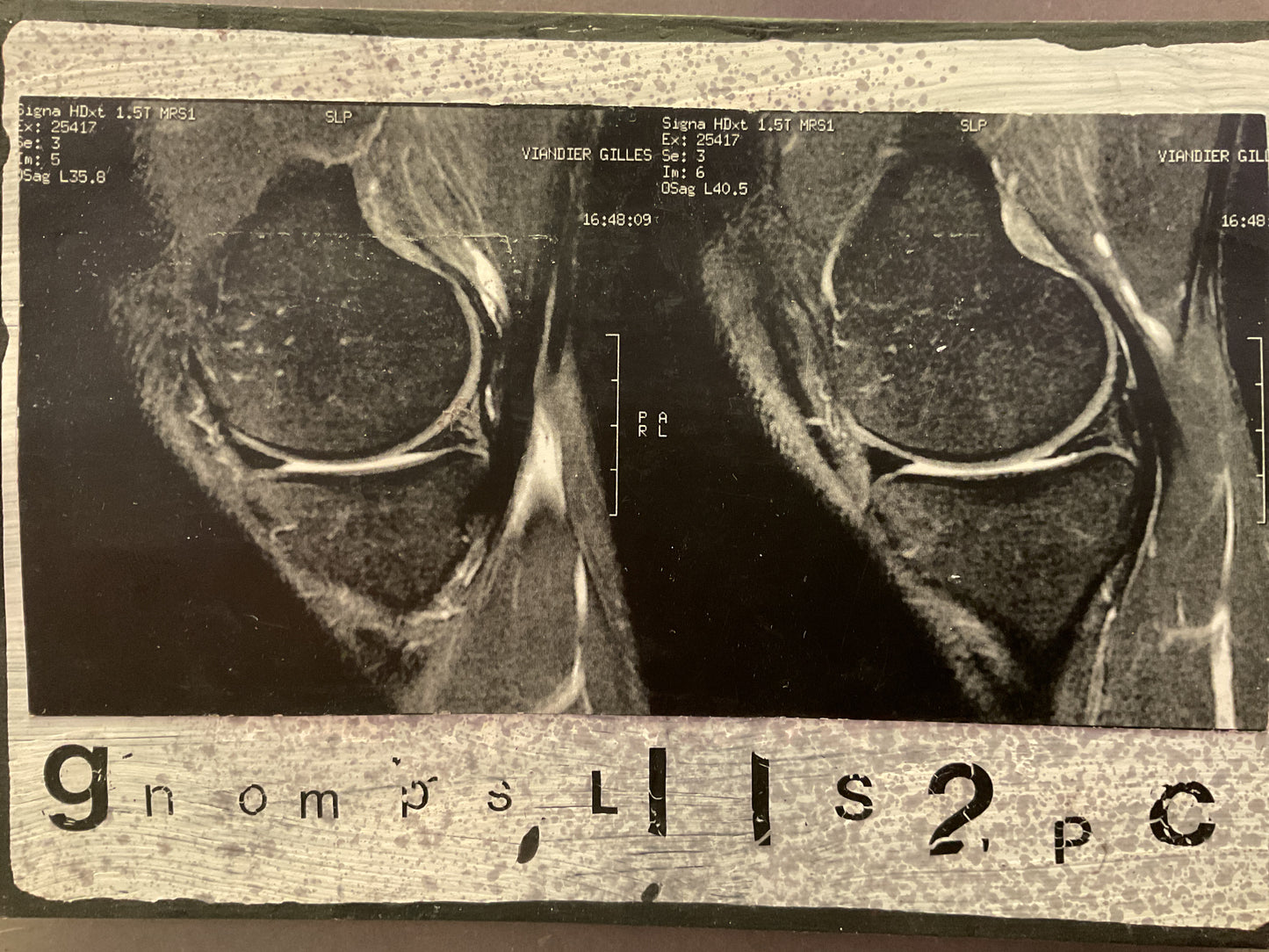 Postcard XRays