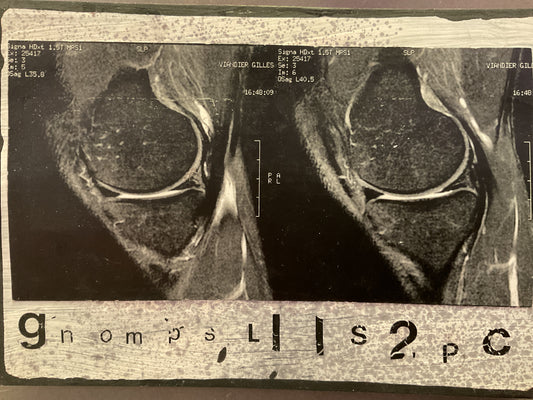 Postcard XRays